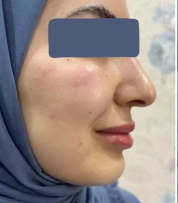 Screenshot_2024-04-09-14-46-54-202_com.instagram.android